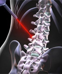 Indian Spinal Injuries Centre Vasant Kunj New Delhi Dr